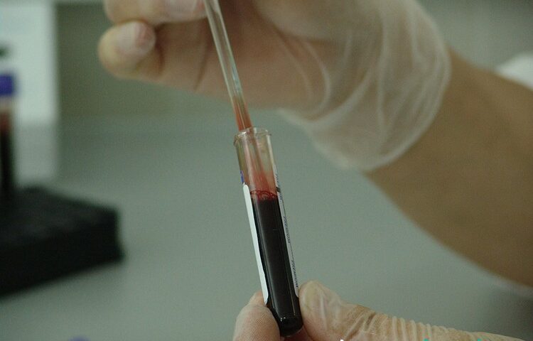 Realizando análisis de plasma rico en plaquetas en laboratorio.