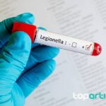 Legionela
